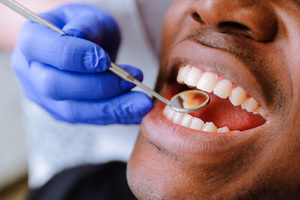 dentist using mirror to examine patient teeth for dental bonding meyerland plaza tx