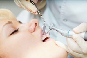 woman having Tooth Polishing 