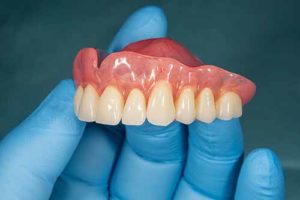 dentist holding a pair of upper dentures