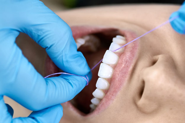 benefits of flossing daily (2) dentist flossing patient talking about the Benefits of Flossing Daily