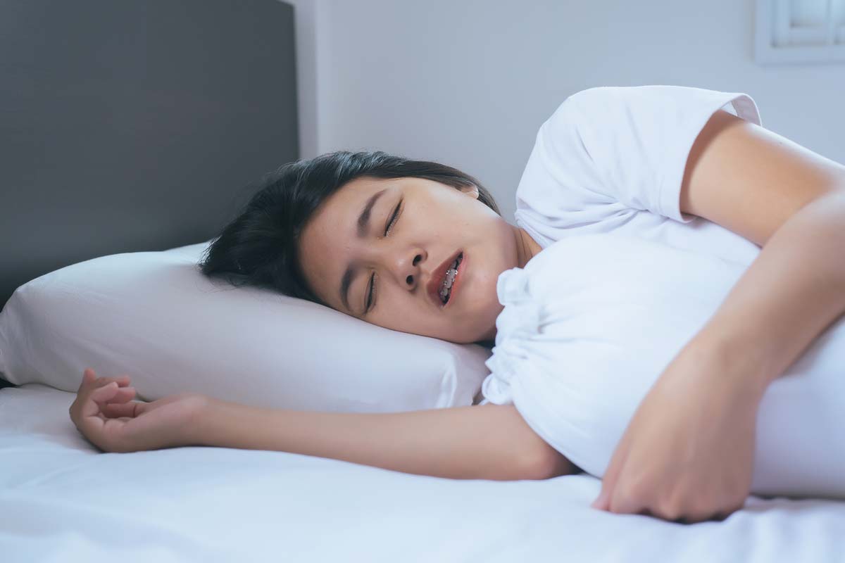 teeth-grinding woman sleeping with nightguard for teeth grinding treatment